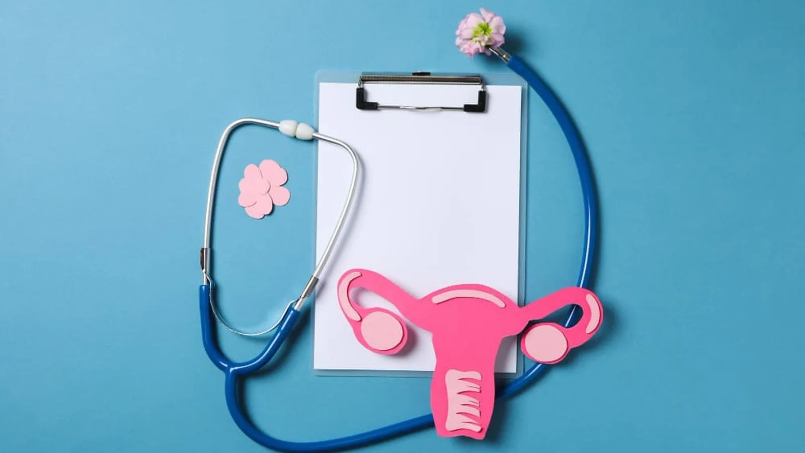 ¿Qué especialista trata el cáncer de ovario?